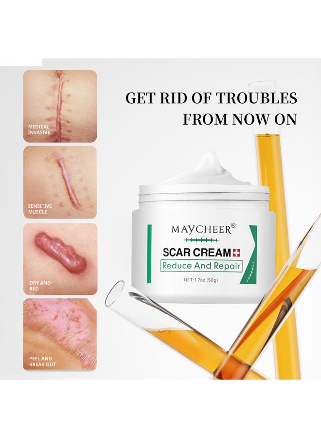 MAYCHEER 3PCS Scar Repair Cream 50g | Specially for Post-operative Burn Scars | Scar Fading and Repair Cream | Skin Ointment, Unisex - Image 4